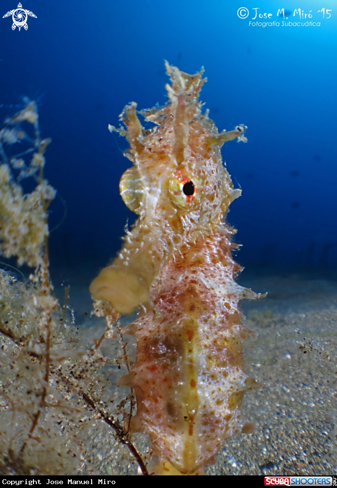 A Hippocampus