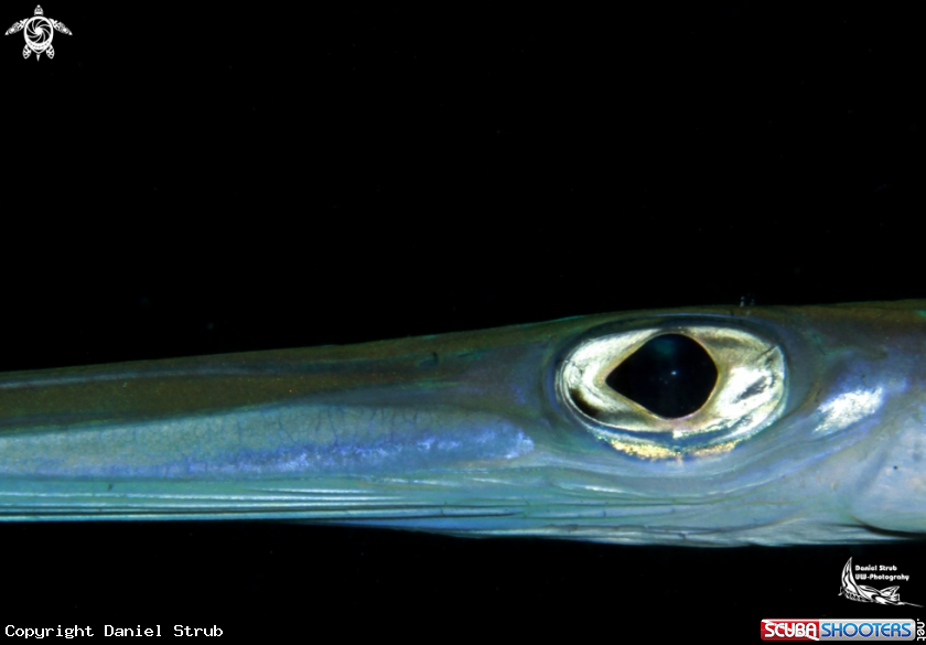 A Fistule